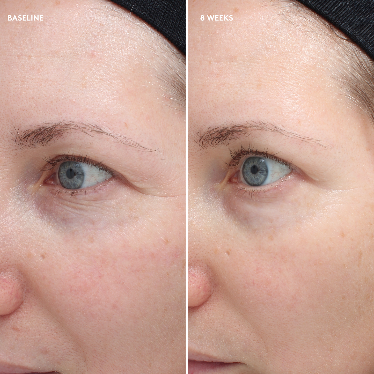 Total Eye Firm and Repair Cream